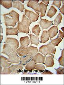 AP1S1 Antibody (N-Term)
