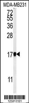 AP1S1 Antibody (N-Term)