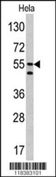 CA9 Antibody (Center)