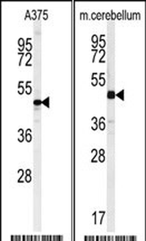 CAC1 Antibody (C-term)