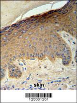 KRT35 Antibody (C-term)