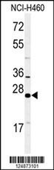 RAB27B Antibody (C-term)