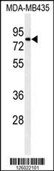ATHL1 Antibody (C-term)