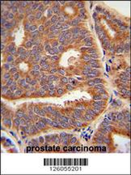 PTPLB Antibody (C-term)