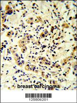CC50B Antibody (N-term)