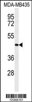 CC50B Antibody (N-term)