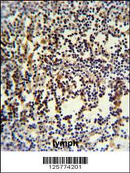 ANR49 Antibody (Center)