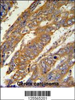 PAN3 Antibody (C-term)