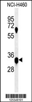 KCTD1 Antibody (C-term)