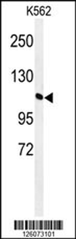 GTD2A Antibody (C-term)