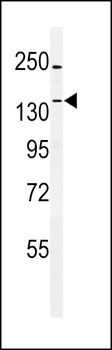 TTBK1 Antibody (N-term)