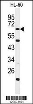 WDTC1 Antibody (C-term)