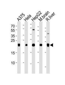 ITPA Antibody (N-term)