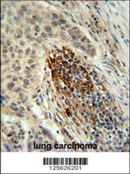 MFAP4 Antibody (C-term)