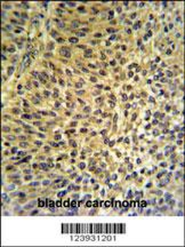 FUT6 Antibody (Center)
