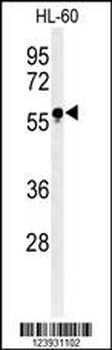 FUT6 Antibody (Center)