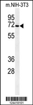 CSGALNACT1 Antibody (Center)