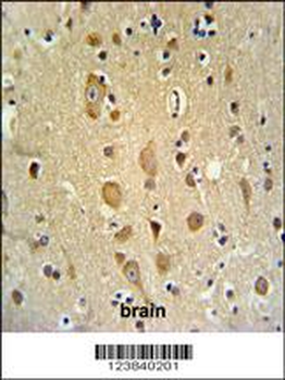 APITD1 Antibody (Center)