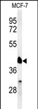RXRA Antibody (Center)