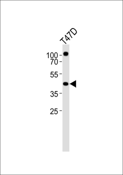 RXRA Antibody (Center)