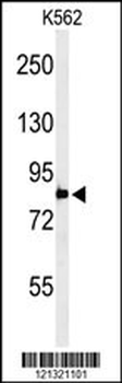 PLA2G4B Antibody (Center)