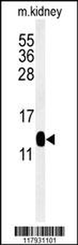 DC13 Antibody (N-term)