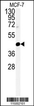 CENPN Antibody (C-term)