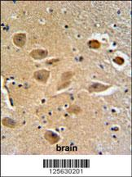 MILK2 Antibody (C-term)