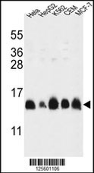 HIST1H2AL Antibody (C-term)