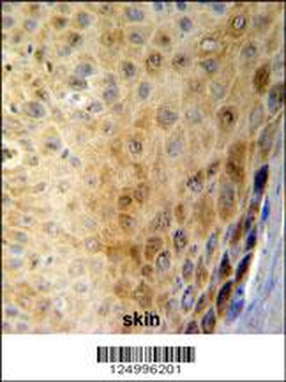 GSDMA Antibody (N-term)