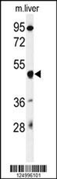 GSDMA Antibody (N-term)
