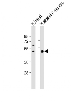 ISLR Antibody (C-term)