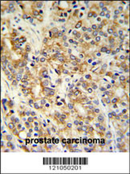 TXNDC12 Antibody (C-term)