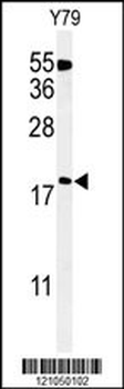 TXNDC12 Antibody (C-term)