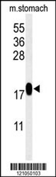 TXNDC12 Antibody (C-term)