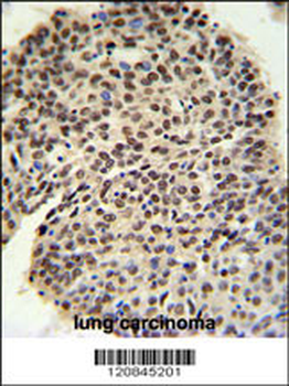 PRPF19 Antibody (N-term)
