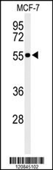 PRPF19 Antibody (N-term)