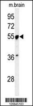 PRPF19 Antibody (N-term)