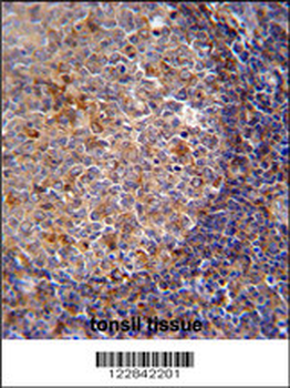 ARHGAP25 Antibody (Center)