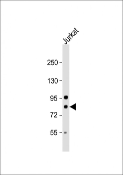 ARHGAP25 Antibody (Center)