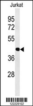 ATF1 Antibody (C-term)