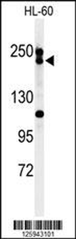 BLM Antibody (C-term)