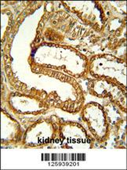 CCR1 Antibody (N-term)