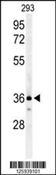 CCR1 Antibody (N-term)