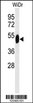 SETD6 Antibody (C-term)