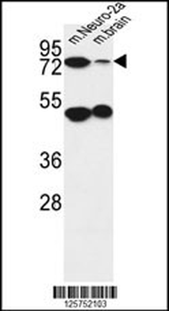 AVL9 Antibody (C-term)