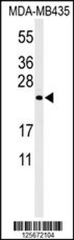 ZCH24 Antibody (C-term)