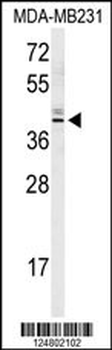 KLDC2 Antibody (C-term)