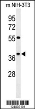 KLDC2 Antibody (C-term)