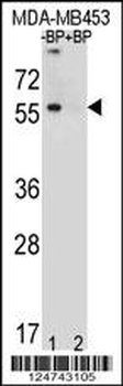 TOX3 Antibody (Center)
